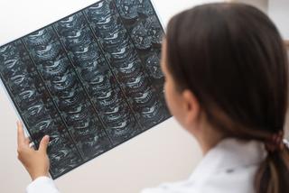 Oförklarlig förändring i mjälten – vad betyder det?