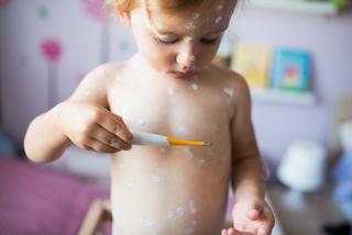 Vattkoppor och bältros - Så hänger det ihop