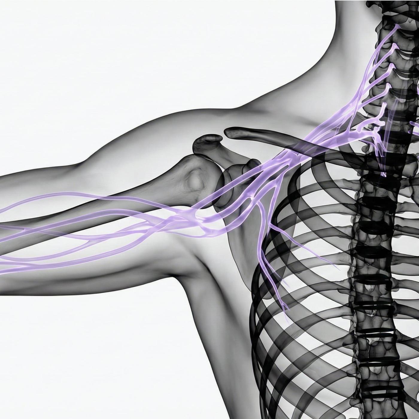 MR Plexus brachialis