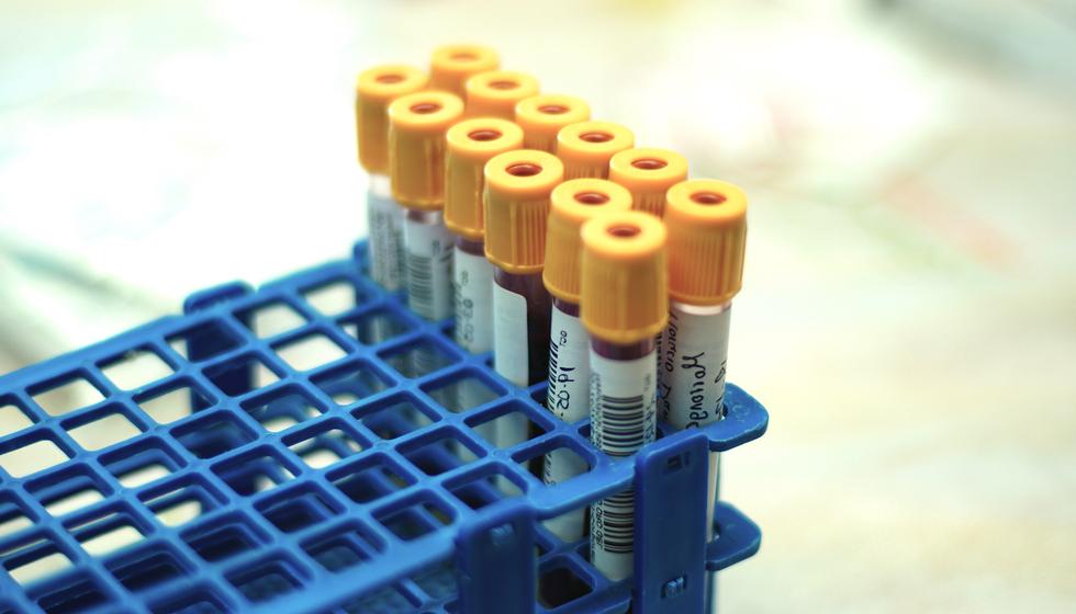 Hur mäter jag kreatin i kroppen? Skillnaden mellan kreatin och kreatinin