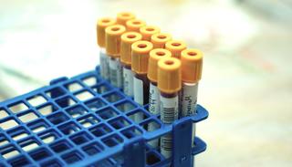 Hur mäter jag kreatin i kroppen? Skillnaden mellan kreatin och kreatinin