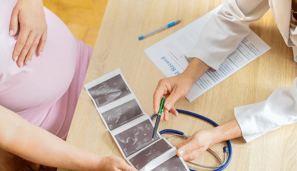 Turners syndrom – upptäcks ofta vid NIPT-test