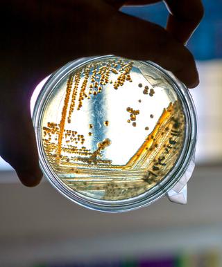 Listeria – den osynliga gästen på ditt matbord