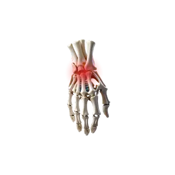 Hälsokontroll - Reumatism