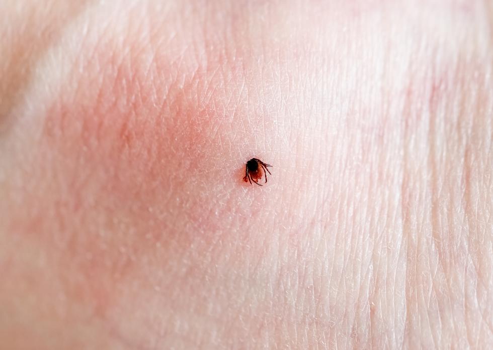 Hur vet man om man har fått Borrelia?