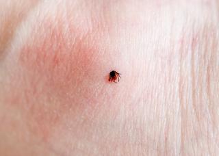 Hur vet man om man har fått Borrelia?