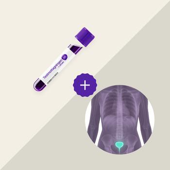 Prostatascreening plus